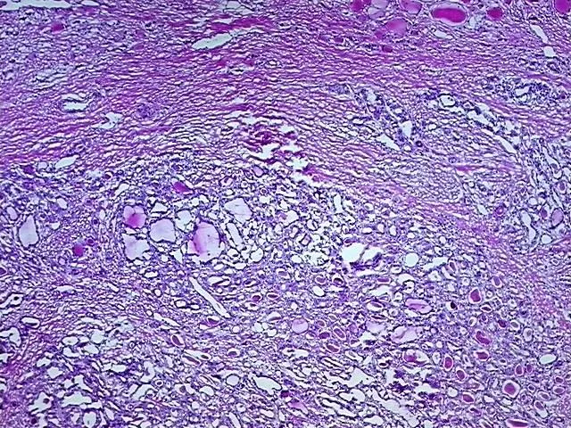 Tissue Total RNA, Thyroid gland - image 1
