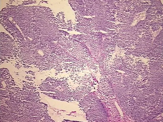 Tissue Total RNA, Urinary bladder - image 1