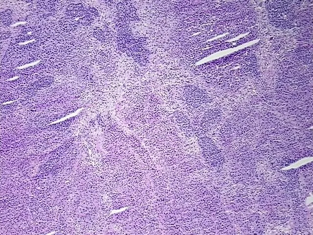 Tissue Total RNA, Ovary: left - image 1