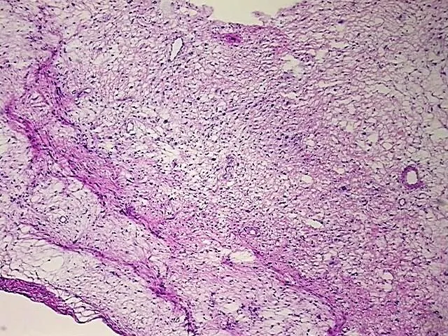 Tissue Total RNA, Soft tissue - image 1