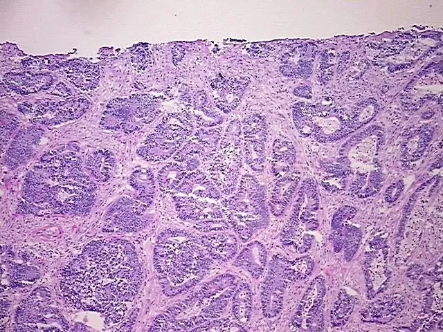 Tissue Total RNA, Rectum - image 1