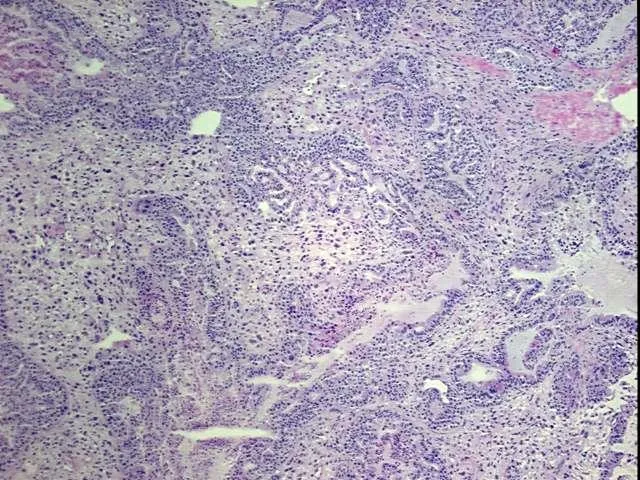 Tissue Total RNA, Lung - image 1