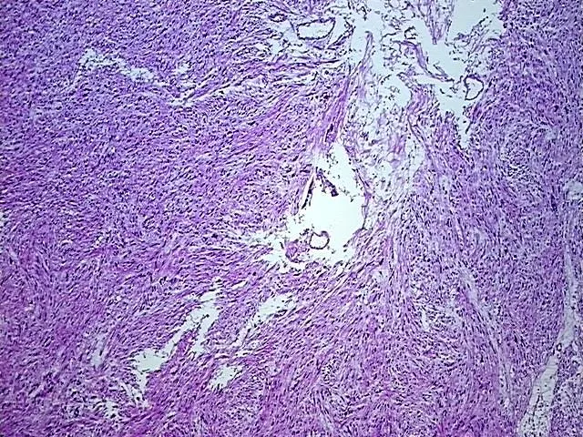 Tissue Total RNA, Soft tissue - image 1