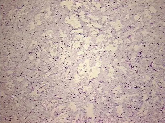 Tissue Total RNA, Soft tissue - image 1