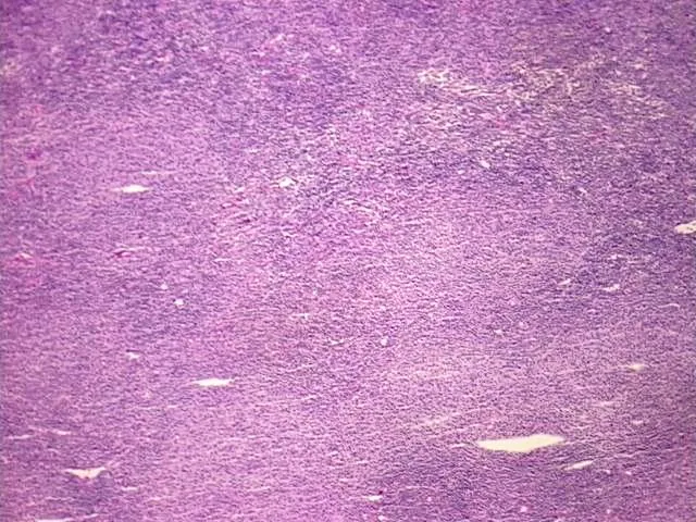 Tissue Total RNA, Lymphoid tissue - image 1