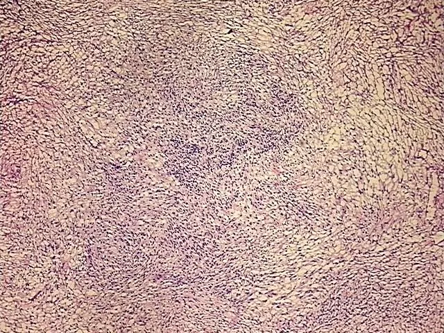 Tissue Total RNA, Soft tissue - image 1