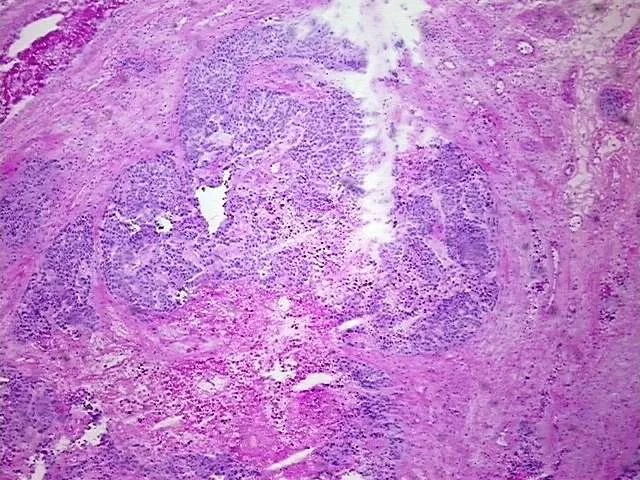 Tissue Total RNA, Testis - image 1