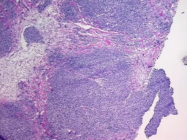 Tissue Total RNA, Lymphoid tissue - image 1