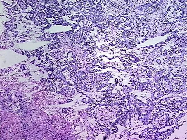 Tissue Total RNA, Ovary: bilateral - image 1