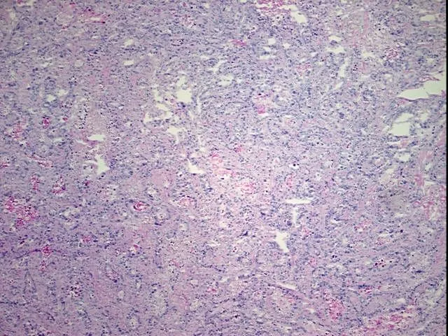 Tissue Total RNA, Esophagus - image 1