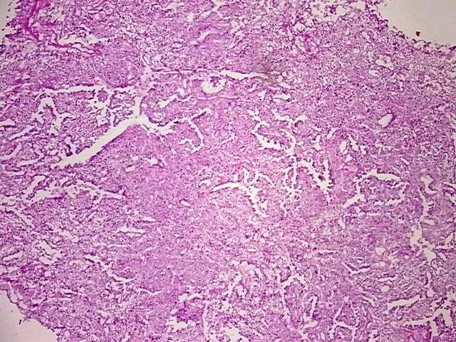 Tissue Total RNA, Ovary - image 1