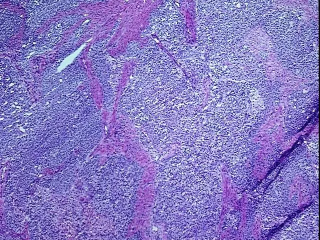 Tissue Total RNA, Endometrium - image 1