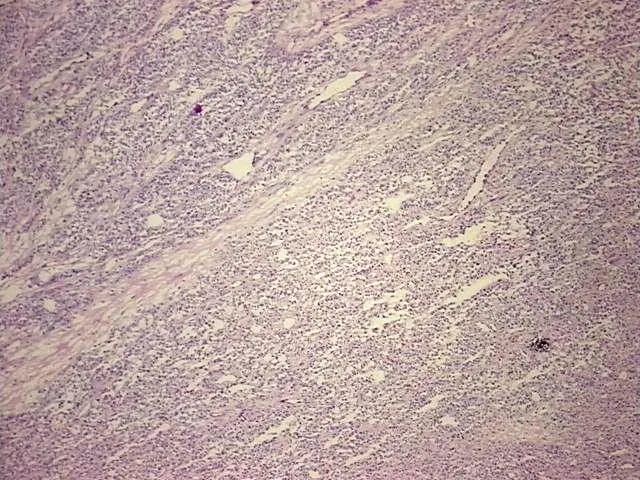 Tissue Total RNA, Skin - image 1