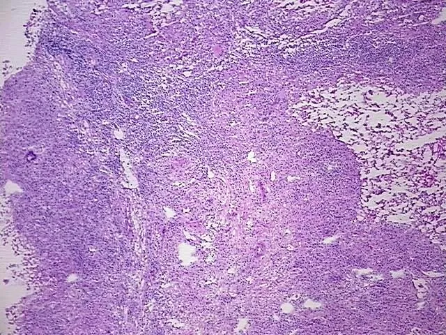 Tissue Total RNA, Urinary bladder - image 1