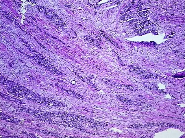 Tissue Total RNA, Urinary bladder - image 1