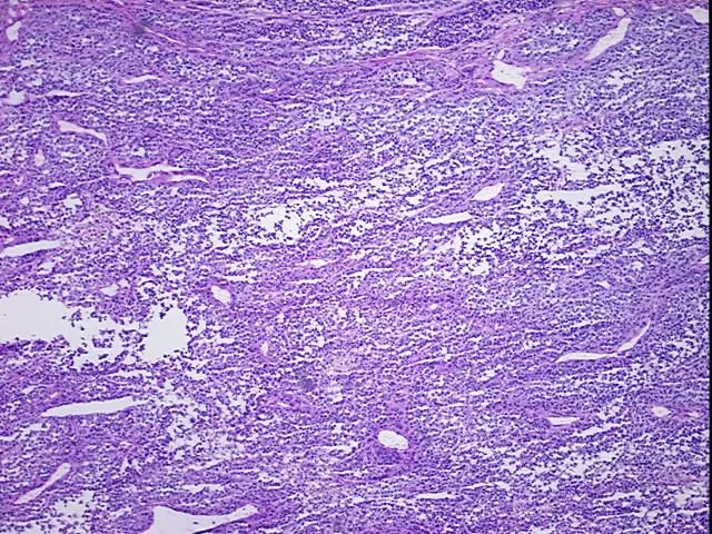 Tissue Total RNA, Skin - image 1