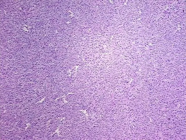 Tissue Total RNA, Soft tissue - image 1