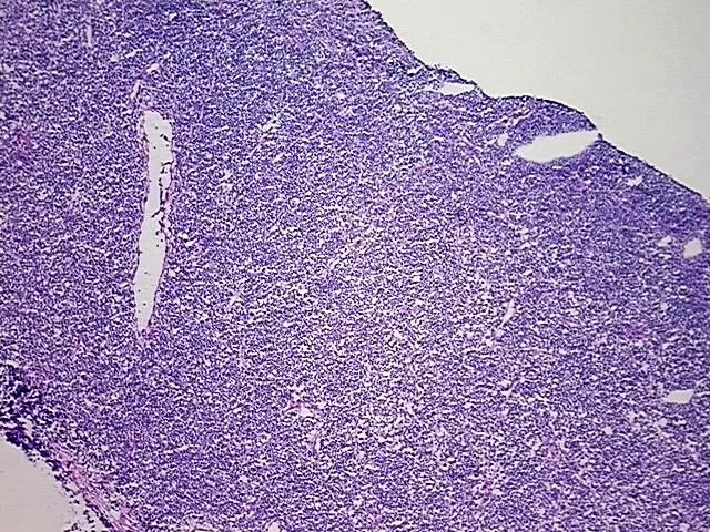 Tissue Total RNA, Lymphoid tissue - image 1