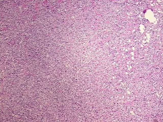 Tissue Total RNA, Bone - image 1