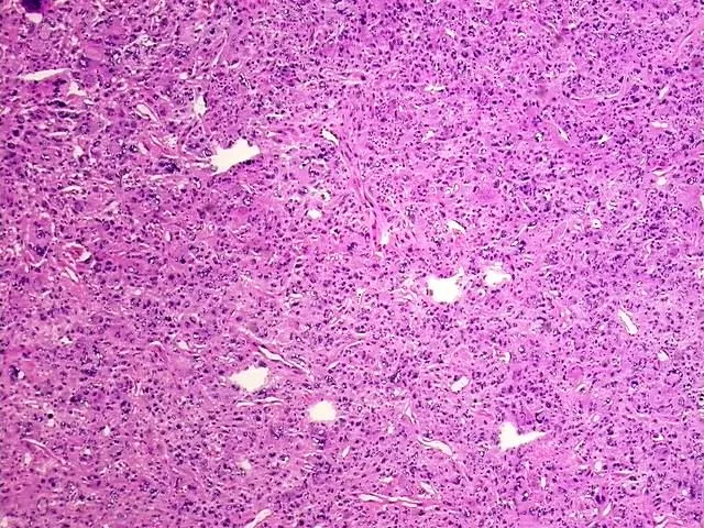 Tissue Total RNA, Soft tissue - image 1