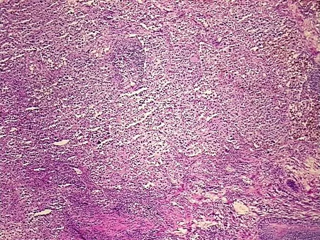 Tissue Total RNA, Skin - image 1