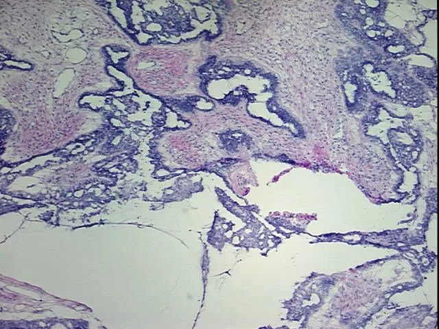 Tissue Total RNA, Ovary - image 1