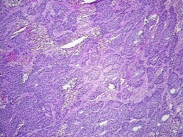 Tissue Total RNA, Lung - image 1