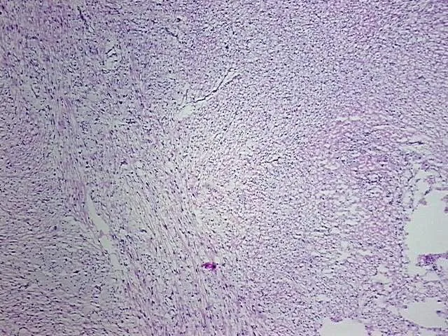 Tissue Total RNA, Soft tissue - image 1