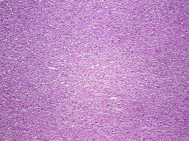 Tissue Total RNA, Brain - image 1