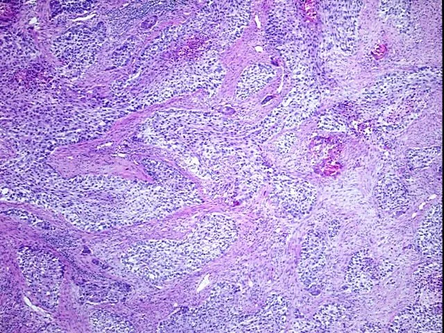 Tissue Total RNA, Lung - image 1