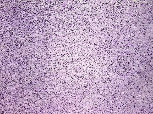 Tissue Total RNA, Soft tissue - image 1