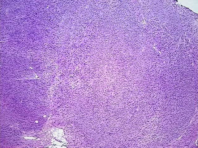 Tissue Total RNA, Soft tissue - image 1