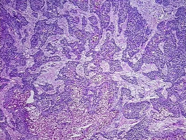 Tissue Total RNA, Urinary bladder - image 1