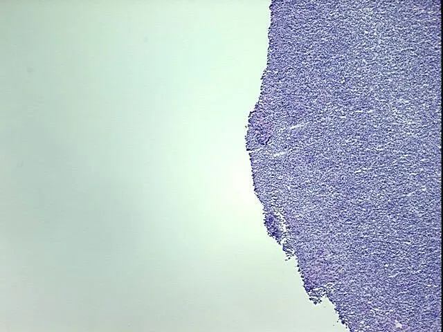 Tissue Total RNA, Lymphoid tissue - image 1