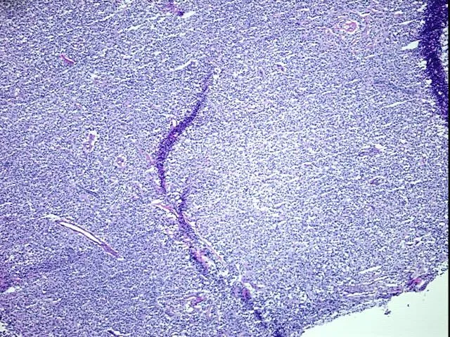 Tissue Total RNA, Lymphoid tissue - image 1