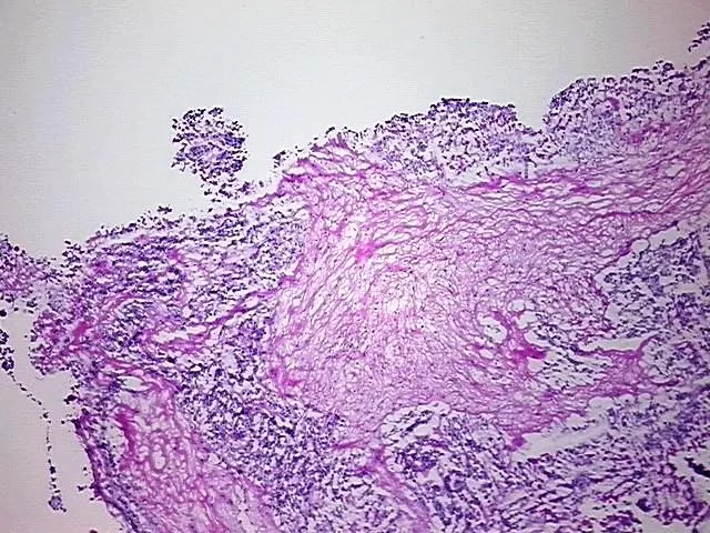 Tissue Total RNA, Testis - image 1