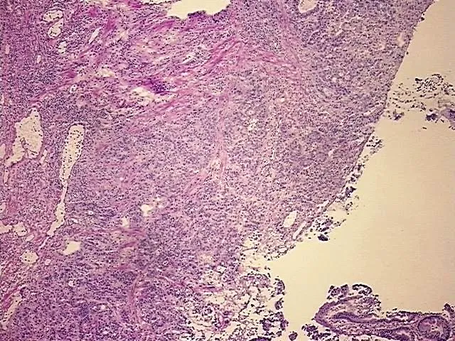 Tissue Total RNA, Stomach - image 1
