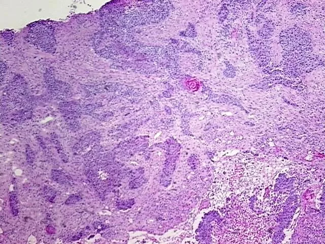 Tissue Total RNA, Esophagus - image 1