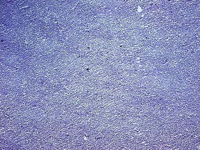 Tissue Total RNA, Lymphoid tissue - image 1