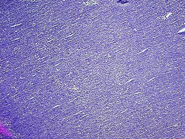 Tissue Total RNA, Lymphoid tissue - image 1