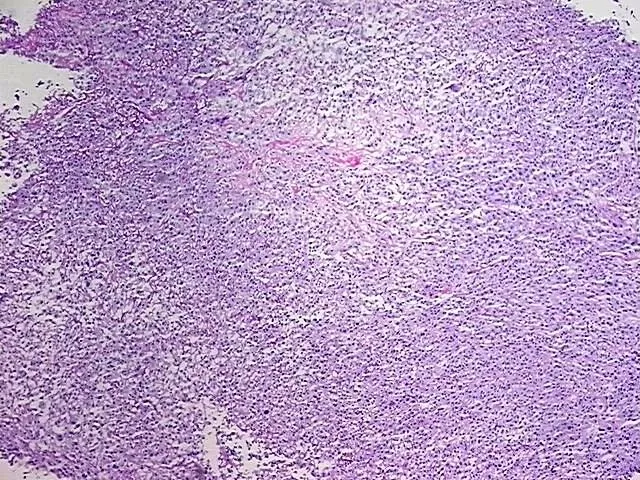 Tissue Total RNA, Soft tissue - image 1