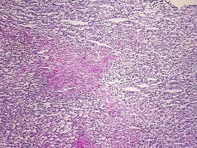 Tissue Total RNA, Urinary bladder - image 1