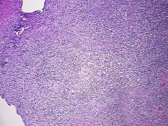 Tissue Total RNA, Lymphoid tissue - image 1