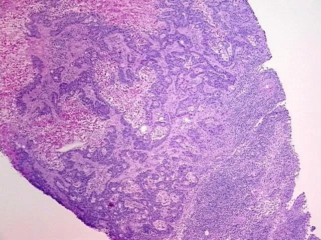 Tissue Total RNA, Rectum - image 1