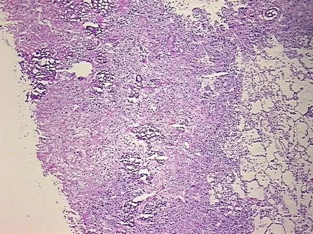 Tissue Total RNA, Bone - image 1