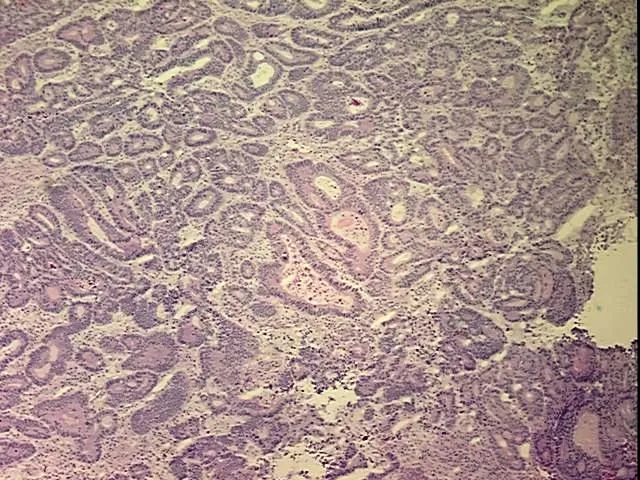 Tissue Total RNA, Colon - image 1