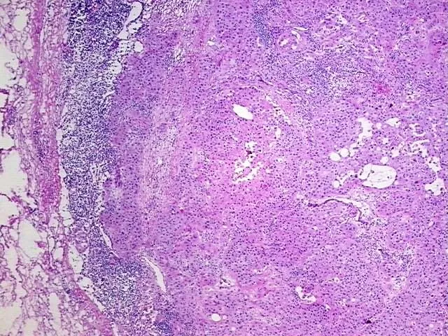 Tissue Total RNA, Urinary bladder - image 1