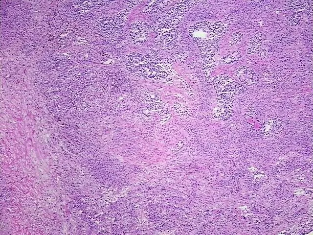 Tissue Total RNA, Lung - image 1