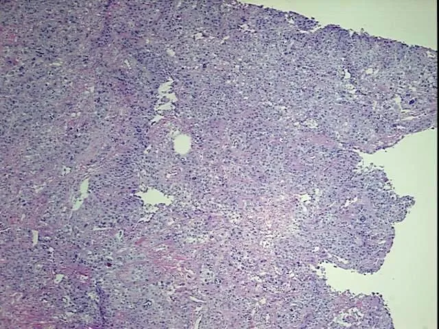 Tissue Total RNA, Lung - image 1