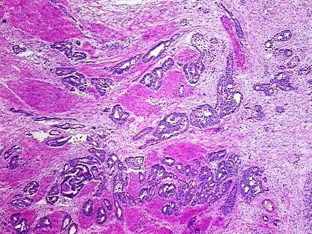 Tissue Total RNA, Rectum - image 1